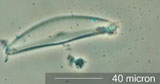 Diatom